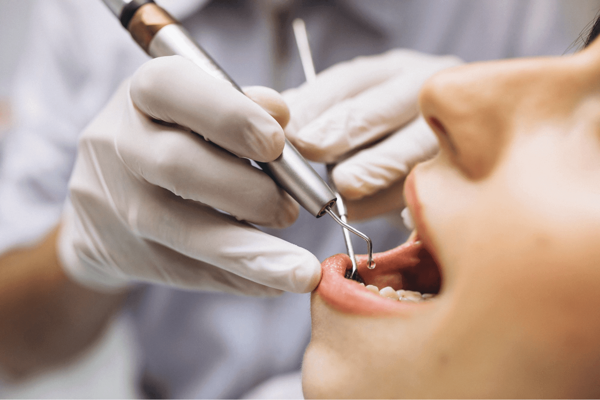 Microscope-assisted root canal treatment at Kayan Dental Clinics