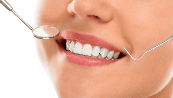 Zoom 4 teeth whitening at Kayan Dental Clinics