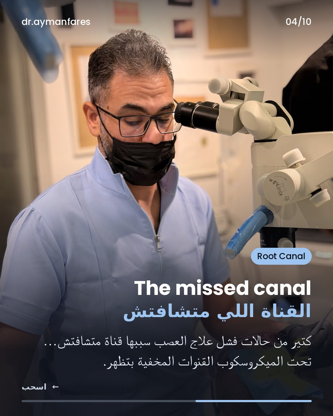 القناة اللي متشافتش — القنوات المخفية اللي بتسبب فشل علاج العصب بتظهر تحت الميكروسكوب