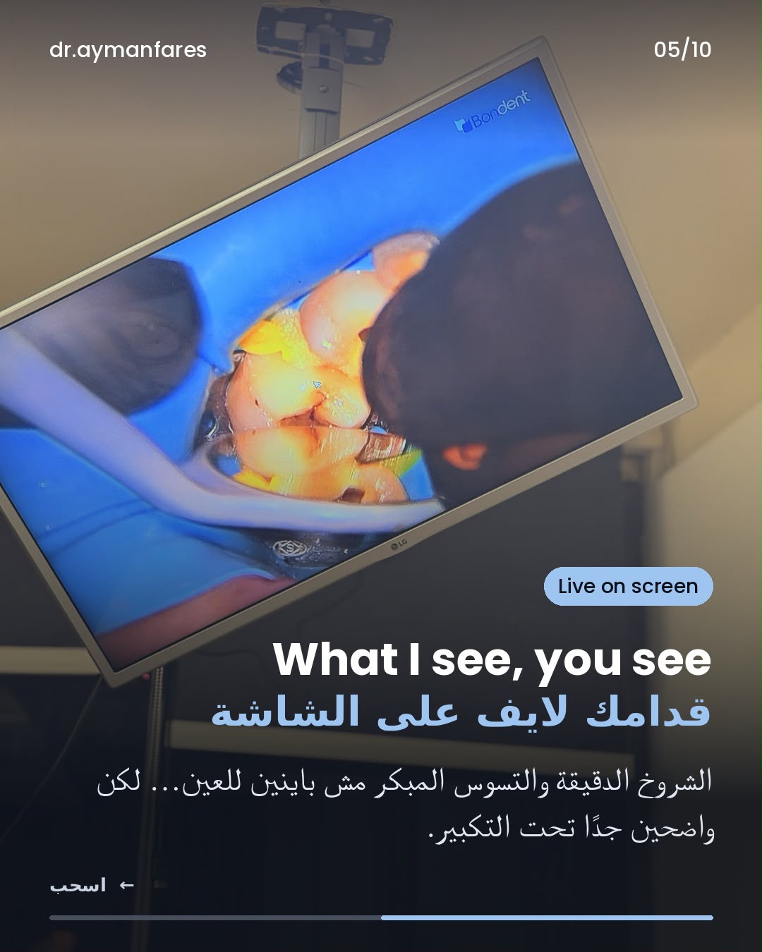 شاشة بتعرض صورة الميكروسكوب لايف — اللي بيشوفه الدكتور بتشوفه إنت